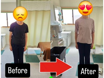 みやび整体院/姿勢不良からの背骨の歪み改善