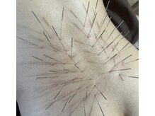 せせらぎ鍼灸院/