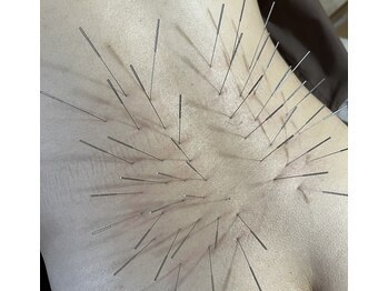 せせらぎ鍼灸院/