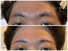 スリーピース(3Peace)/アーチ眉 Before/After