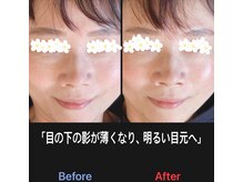 美容矯正サロン レレポノ(LELEPONO)/