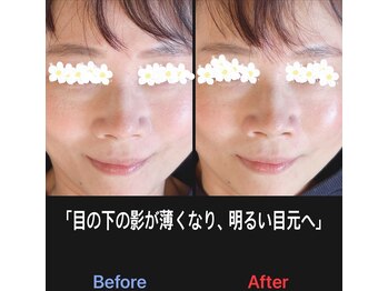 美容矯正サロン レレポノ(LELEPONO)/