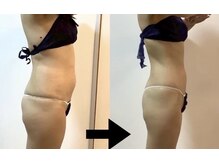 メルシー サロン(Merci Salon)/セルゼロ