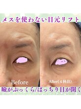 ケイ プレジール/【大阪・本町】目もと激変リフト