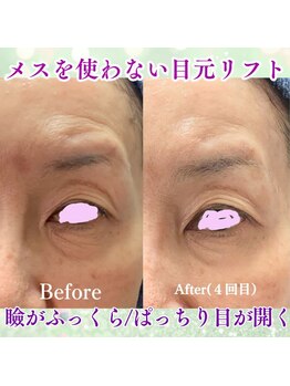 ケイ プレジール/【大阪・本町】目もと激変リフト