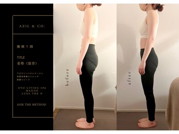 オーヴォ リビングスパ アネックス マノン(OVO LIVING SPA annex MANON)/【施術事例】猫背・巻肩改善