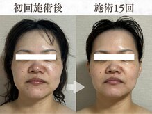 メイヴィ 四日市(Maivi)の雰囲気(【40代女性15回の変化!】四日市 エステ/四日市 フェイシャル)