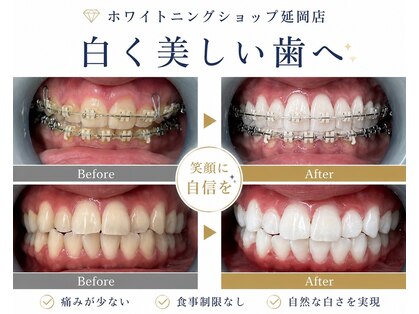 ホワイトニングショップ 延岡店の写真