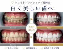 ホワイトニングショップ 延岡店