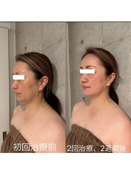 ランスソア(L'ins soi)/