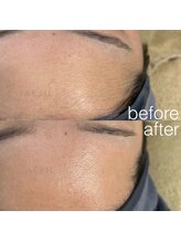 ジェジル バイ ジュリ(JAEJIL by Juri)/顔脱毛/フェイシャルワックス