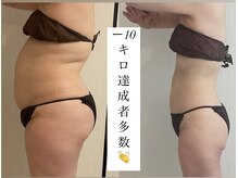 ビー肌スパ(Be肌スパ)の雰囲気（ー10キロ達成者が多数◎適正体重を一緒に目指します！）