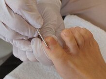 東京巻き爪研究所 みなみ風