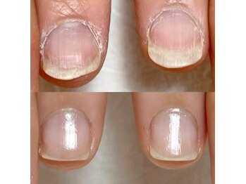 エマネイル(emma nail)の写真/【自爪育成ケア/巻き爪ケアあります◎】爪のお悩み・短い爪も形にこだわり清潔感のある魅せるお手元に！