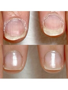 爪の悩みを解消できる（ケア含む）