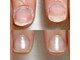 エマネイル(emma nail)の写真/【自爪育成ケア/巻き爪ケアあります◎】爪のお悩み・短い爪も形にこだわり清潔感のある魅せるお手元に！