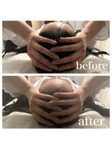 ルビー 池袋店(Ruby)/頭蓋骨矯正1回ビフォーアフター