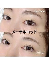 レディエント 北浦和店(Radiant)/メーテルロッド