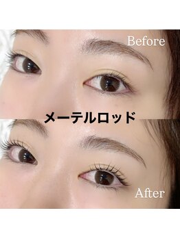 レディエント 北浦和店(Radiant)/メーテルロッド