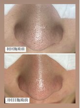 フラリス(fraris)/