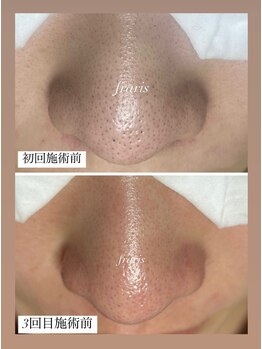 フラリス(fraris)/