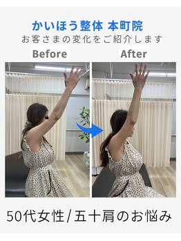 かいほう整体 本町院/痛くて動かせない肩（４）