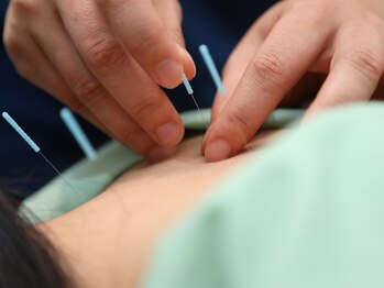 シンク(Sync)/鍼灸