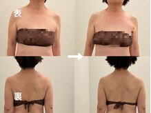 ヴィセラ(Vicella)/年齢関係ないです！