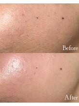 ロイヤルキューティー 介正鍼灸整骨院 コマーシャルモール博多(ROYAL QT)/フェイシャルWAX脱毛