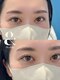 アンドモア(And more)の写真/マツパ派もエクステ派も虜！＆Healthyで叶える「大人可愛い」の新常識。自然なのに存在感のある目元へ☆