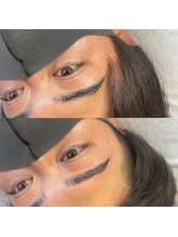 ビトタン 倉敷本店(+美to鍛)/回数を重ねるとビフォーも美しい