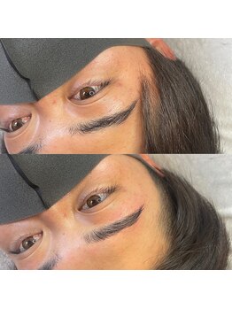 ビトタン 倉敷本店(+美to鍛)/回数を重ねるとビフォーも美しい