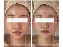 サロン リーナ 北千住店(Salon Lena)/商標登録手技★骨造コルゾウ