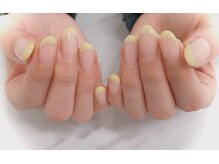 アメリオレフチュール(ameliorer futur)/NAIL