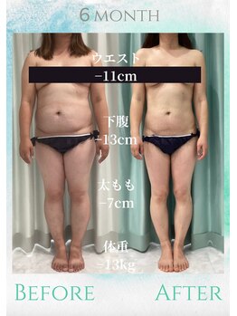 エデン(Eden)/サイズダウン★痩身