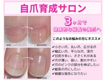 ミミ(mimi)