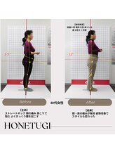 ほねつぎ総社 はりきゅう接骨院/成果/肩こり・腰の痛み