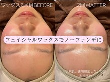 ケアズ(CARES)/フェイシャルワックス