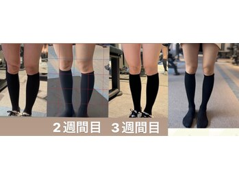 ハーモニーフィットネス 赤坂(Harmony Fitness)/膝上肉撃退