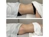 YOLO式腸もみモニター限定クーポン　通常¥11,000→¥6,600