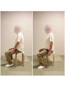 ツリー鍼灸整骨院 吹田店(TREE鍼灸整骨院)/歩きづらさにも！