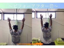 ケアるら整骨院 富里院/ビフォーアフター