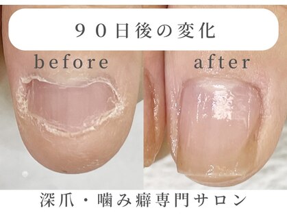 ネイルサロン ミノアッカ(mino'aka)の写真