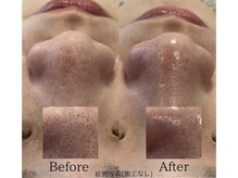 アイアール(ir)の雰囲気（他では体感出来ないウル艶肌　ハイドラ毛穴洗浄）