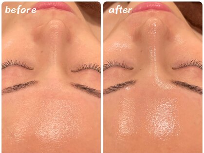 リボーン(Reborn)の写真