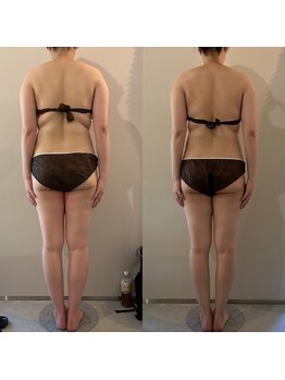 ラナ 京都西院店(Lana)/よもぎ＆全身リンパマッサージ