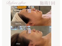 パルタージュ(Partage)/