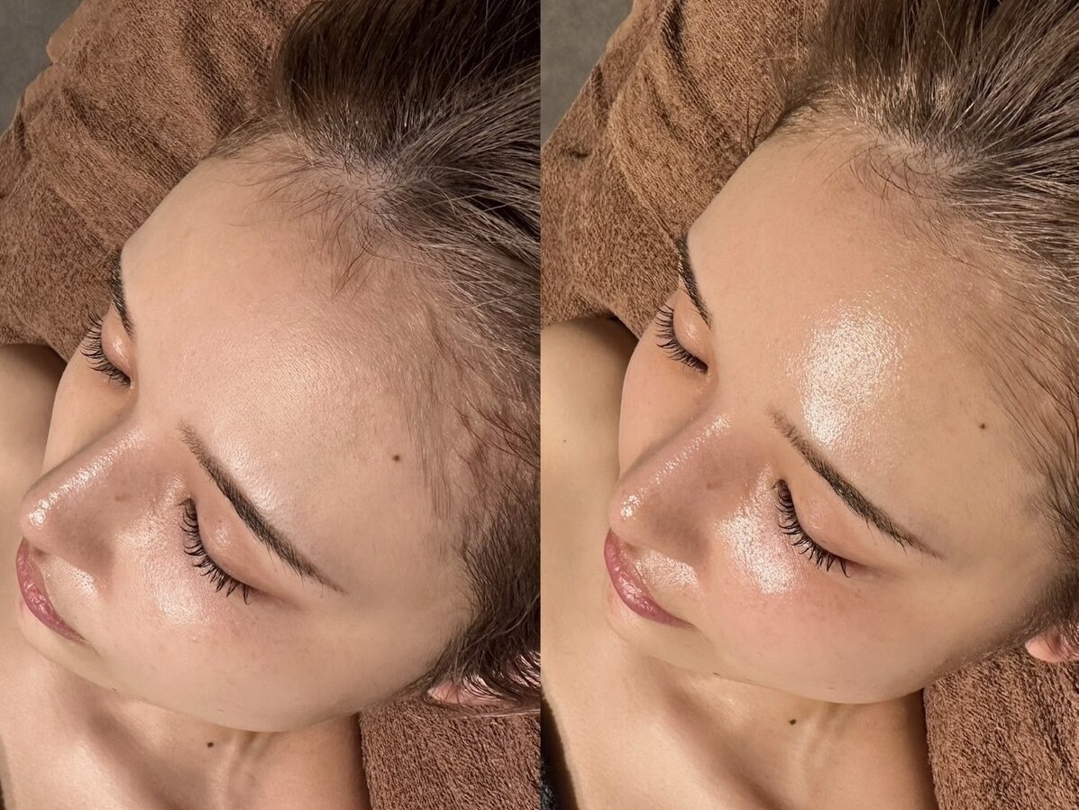 【乾燥肌を改善】高濃度酸素導入+専用美溶液導入+泡パック付 \16500