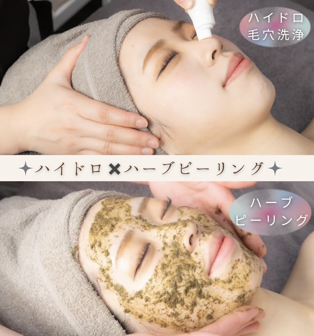 【人気No．1】悩みのないお肌に♪ハイドロ×ハーブピーリング￥33000→￥8800