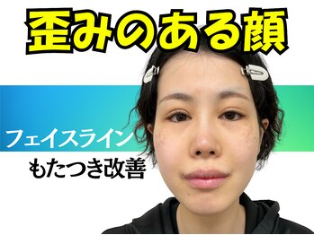 ナチュラルパーフェクトフェイス 新宿/歪みのある顔